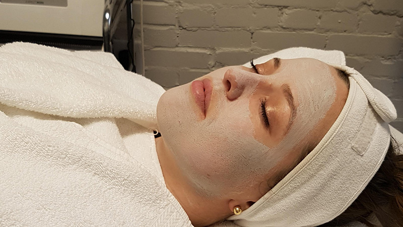 AFA-Clay-Acne-Application AFA Clay Acne at Midtown Med Spa