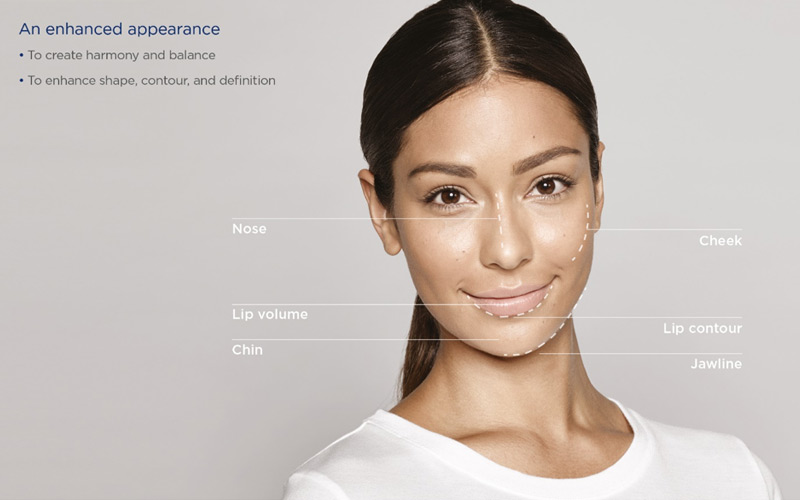 Restylane-Enhance Restylane Enhance