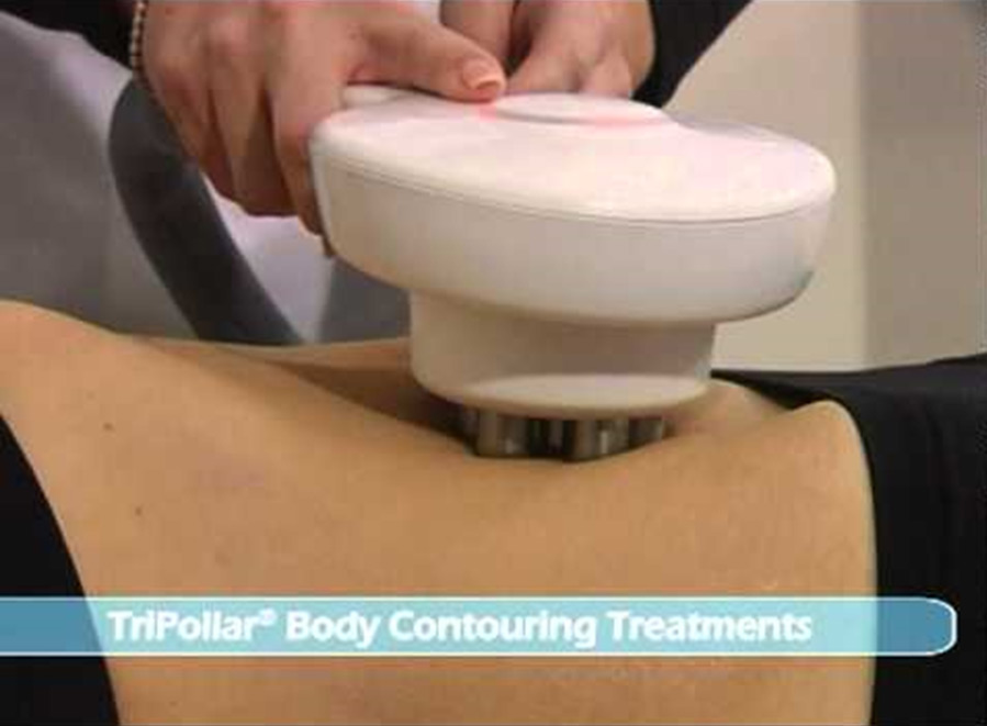 Tripollar Body Contouring